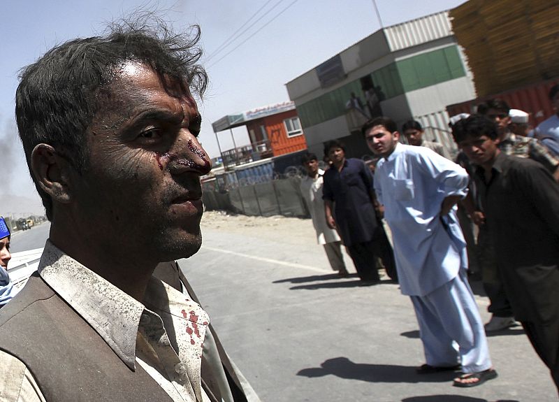 A Afghan man wounded in a suicide attack walks away from the site of the attack in Kabul