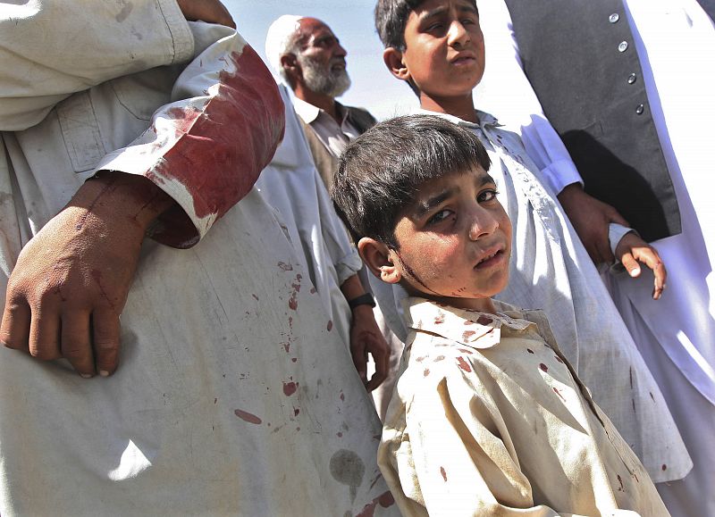 Afghan boys slightly wounded by a suicide attack wait for transport in Kabul