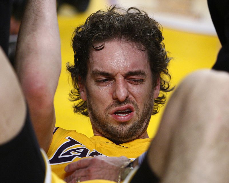 Lakers' Gasol winces after being hit in the eye during the second half of their NBA basketball game against the Heat in Los Angeles