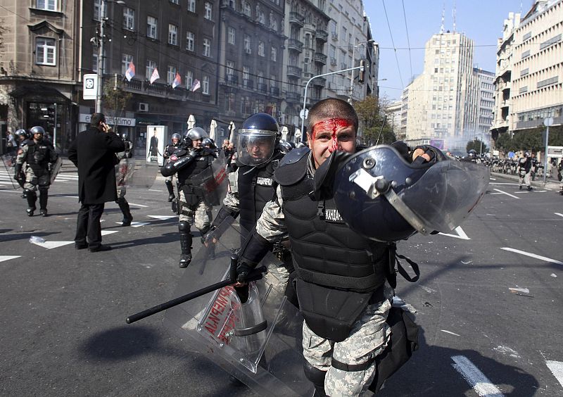 An injured riot policeman walks during clashes with anti-gay protesters in Belgrade