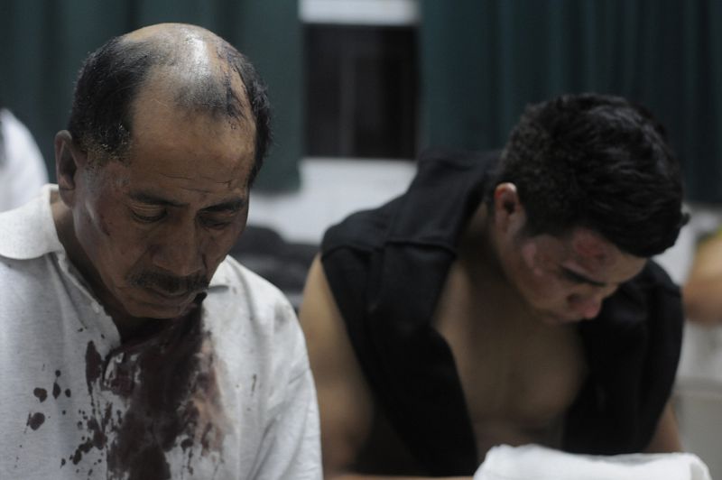 Dos hombres esperan a ser atendidos en el Hospital Roosevelt de Ciudad de Guatemala tras resultar heridos por la explosión de una bomba en el autobús.