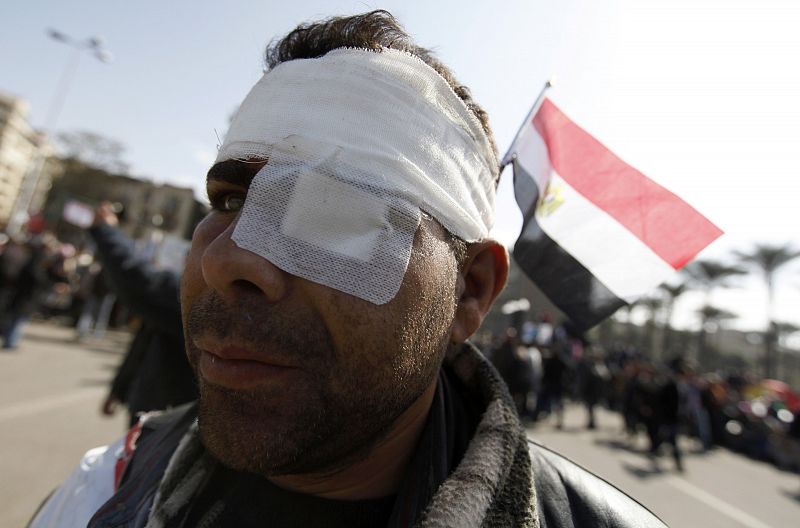 An injured opposition supporter walks through Tahrir Square in Cairo