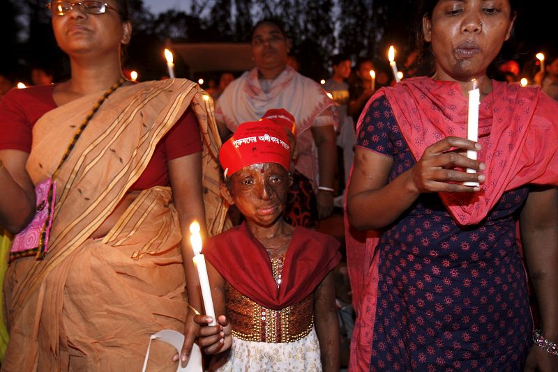 Los ataques con ácido son muy habituales en Camboya, Afganistán, la India, Bangladesh, Pakistán y otros países. Se estima que un 80% de los ataques con ácido son contra mujeres y un 40% contra mujeres menores de 18 años.