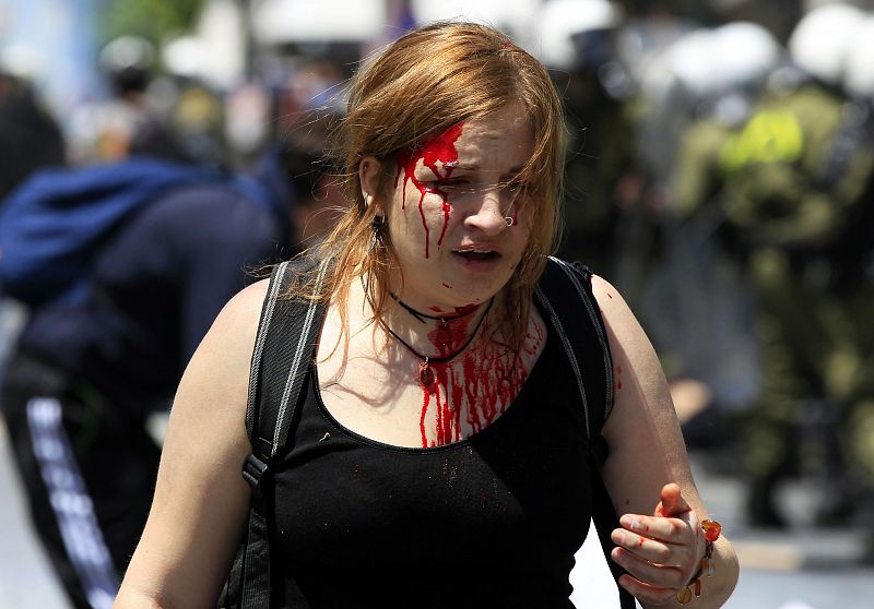 Una manifestante herida en los enfrentamientos con la policía en Atenas