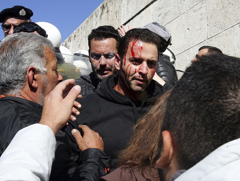 Un manifestante herido durante los enfrentamientos registrados en Atenas