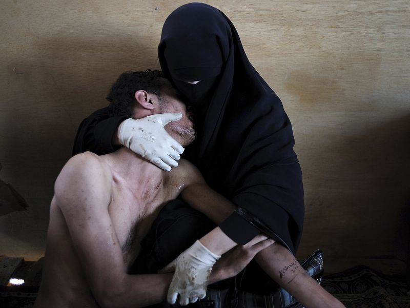 Aranda of Spain has won World Press Photo of the Year 2011 with this picture of woman holding wounded relative during protests against president Saleh in Sanaa