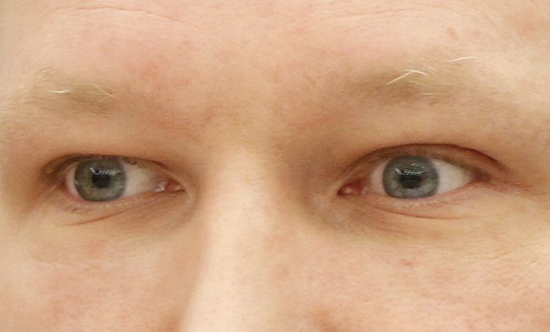 Breivik, acusado de 77 muertes