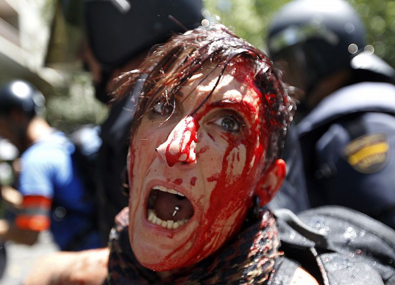 Manifestante herida por la Policía