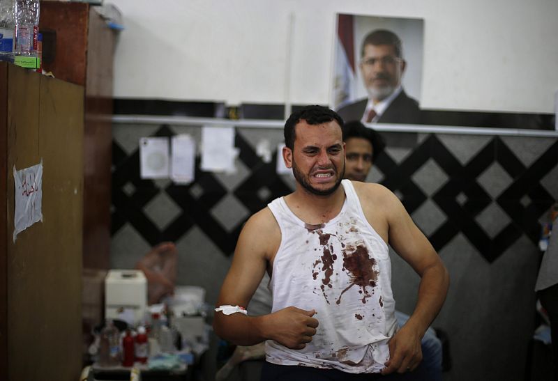 A wounded supporter of deposed Egyptian President Mohamed Mursi reacts at a local hospital in Cairo