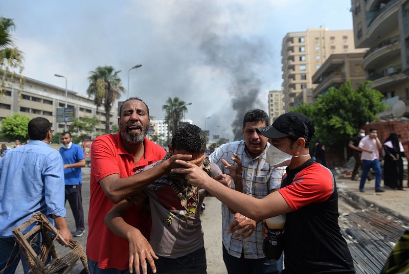 Un joven egipcio, uno de las docenas de heridos por la policía en El Cairo.