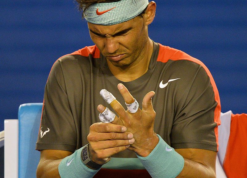 Nadal sufre por la herida en su mano izquierda