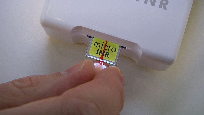 ¿Qué es un coagulómetro?