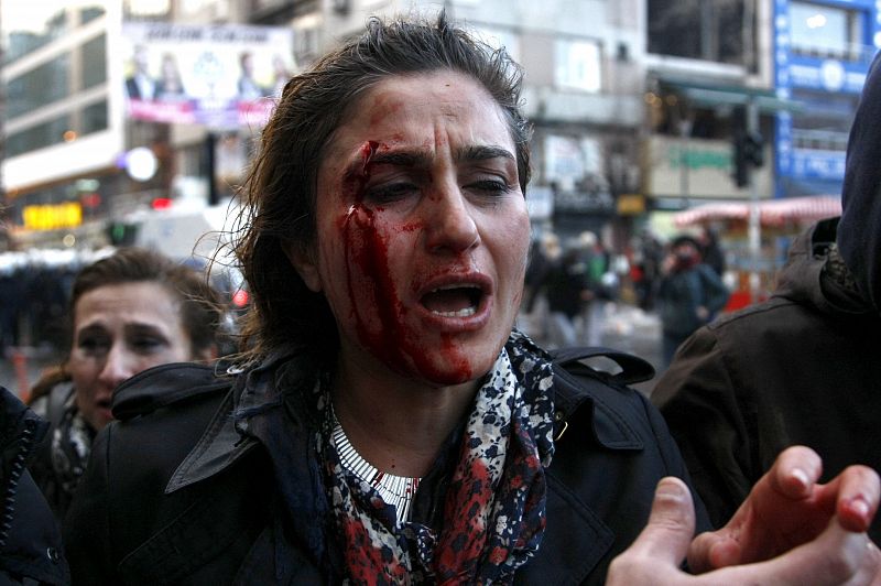 Una mujer herida es ayudada durante una protesta convocada en Estambul por la muerte de Berkin Elvan