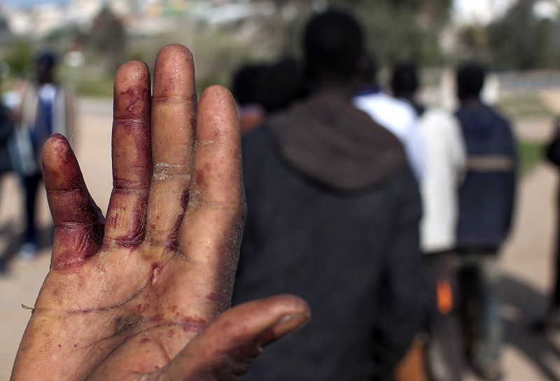 Uno de los inmigrantes muestra las heridas en una mano tras saltar la valla de Melilla