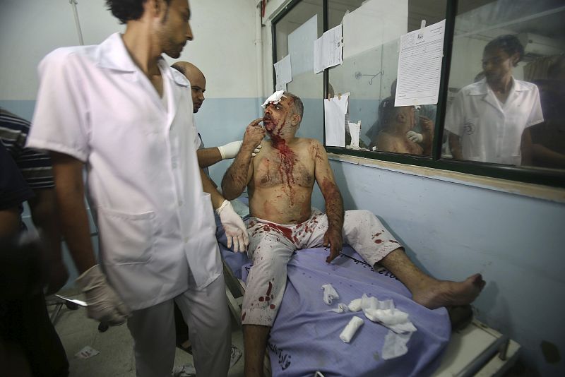 Un palestino herido en los bombardeos es atendido en el hospital de Jan Younis en Gaza