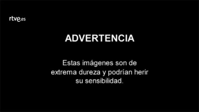 Advertencia: algunas de las imágenes que se muestran a continuación pueden herir la sensibilidad