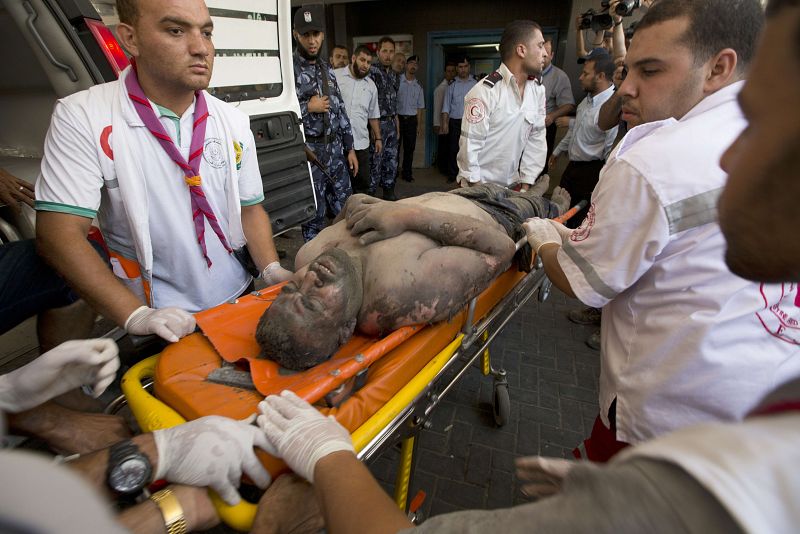 Un herido llega al hospital Al Shifa, en la ciudad de Gaza