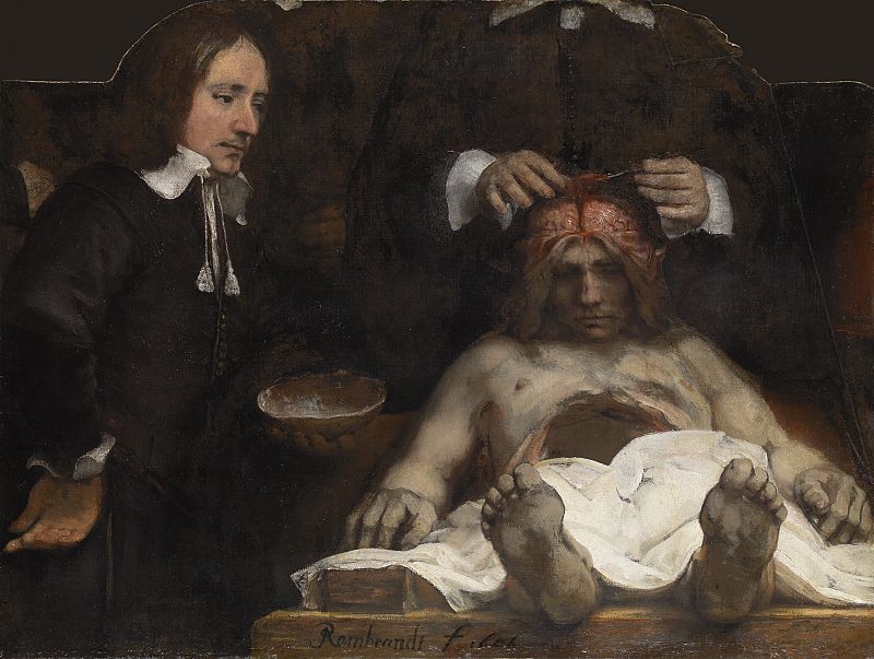 Rembrandt, "Lección de anatomía del doctorJoan Deyman", (1656)