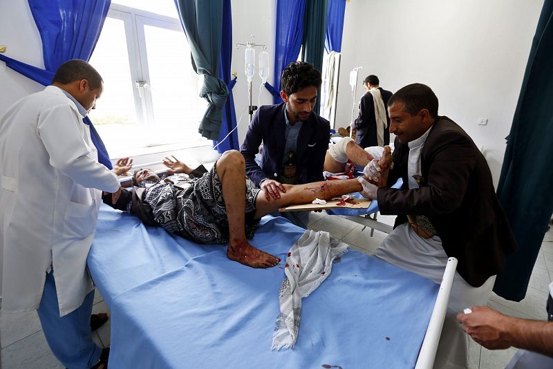 Yemeníes heridos reciben atención médica en un hospital de la capital de Yemen.ES EN SANÁ