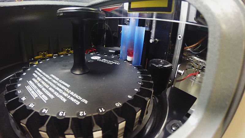 Aquí se comprueba que la sangre no está contaminada