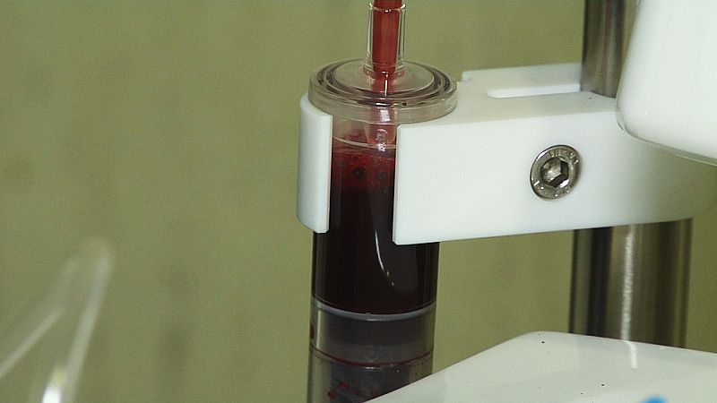 Se separan plaquetas y glóbulos rojos de las células