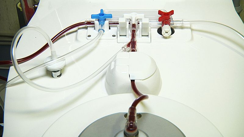 Se hacen análisis para determinar que la muestra es válida