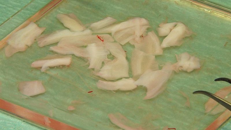 El cordón umbilical se limpia y se corta en trozos pequeños