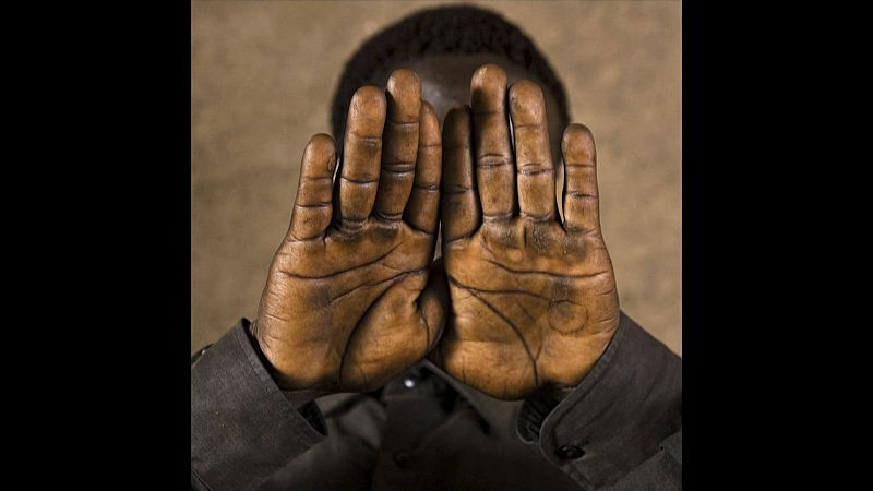 Paul, 17 años. Uganda. Cuando regresó a su casa, después de haber estado 10 años preso por una de las guerrilla de su país, a penas podía mover las manos por las torturas.