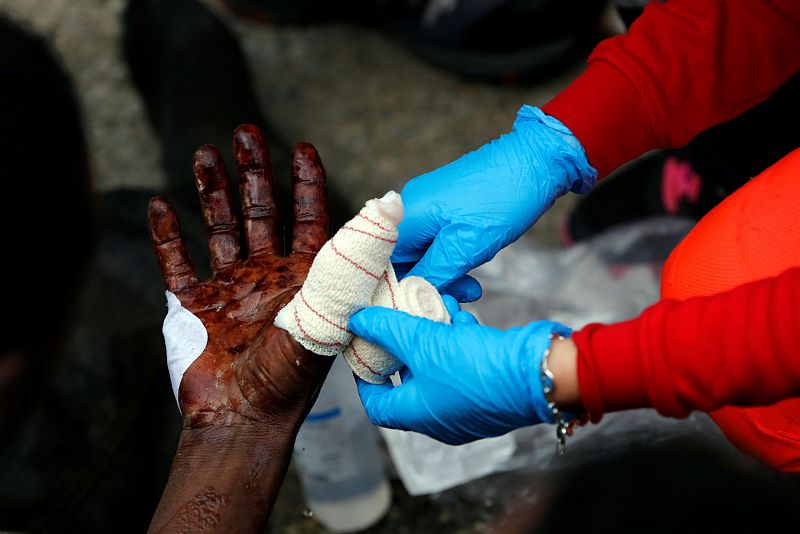 Un inmigrante subsahariano es atendido de heridas en la mano tras un intento masivo de salto a la valla de Ceuta.