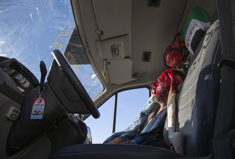 Un hombre herido permanece sentado en una ambulancia en el barrio rebelde de al-Amiriyah a la espera de ser trasladado a zona bajo control gubernamental.