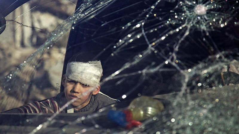 Niño herido en una ambulancia en el barrio de Al Amiriya, en Alepo, esperando a ser evacuado por la Cruz Roja