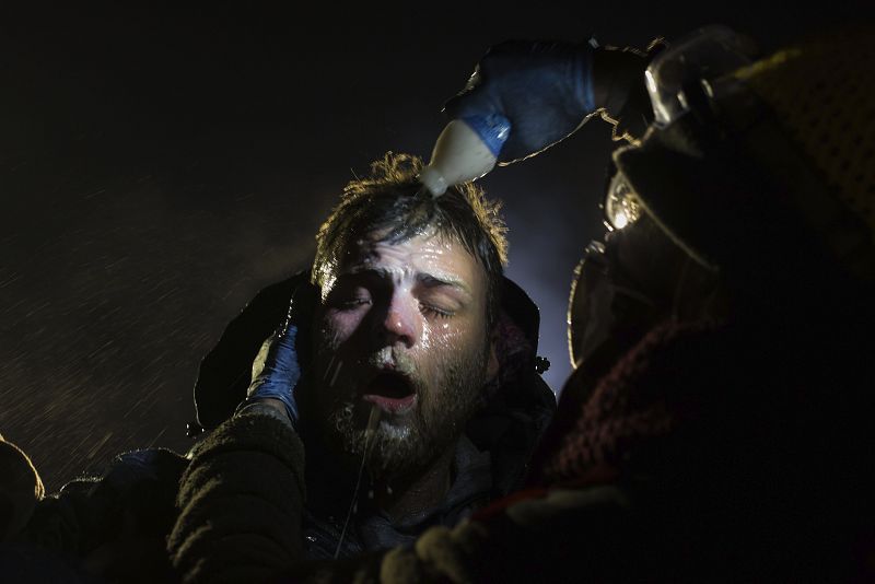 La imagen, titulada "Standing RockPhoto", muestra un hombre que es tratado con leche de magnesia tras ser rociado por la policía con espray pimienta durante una protesta en contra de la construcción del oleoducto Dakota Access Pipelines, en Estados U