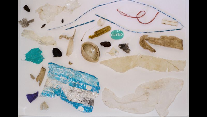 Restos plásticos hallados en el interior de una tortuga boba en Sant Antoni, Ibiza
