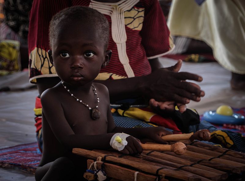 Estimulación cognitiva con música para niños con malnutrición severa hospitalizados en el Hospital Central de Koutiala.