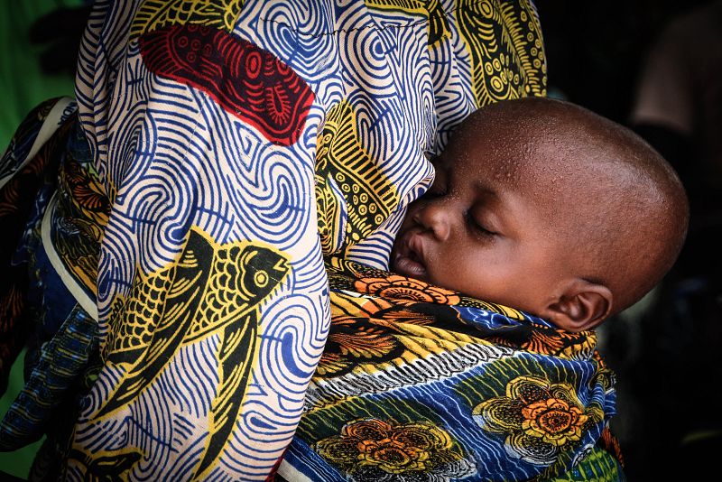 La malnutrición crónica tiene consecuencias irreversibles a nivel físico y cognitivo.