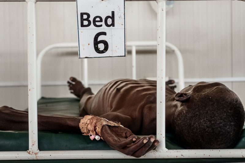 Un enfermo de tuberculosis, aislado en el área dedicado a estos enfermos.