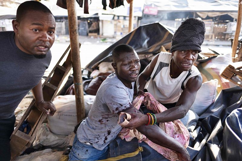Heridos en las protestas de Zimbabue