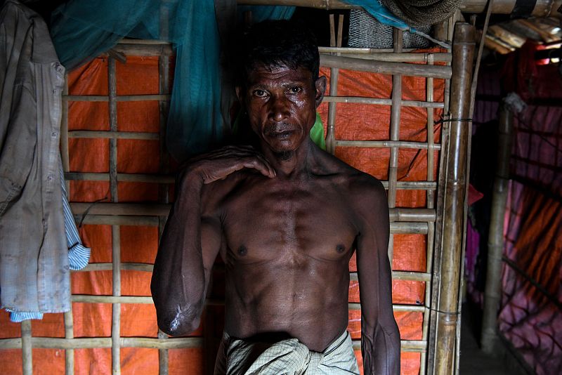 Un refugiado rohinyá posa en su tienda de campaña