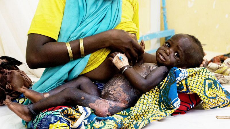 Una madre se dispone a amamantar a su bebé desnutrido en el Hospital de Zinder (Níger).
