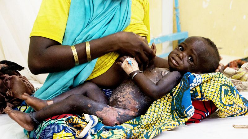 Una madre se dispone a amamantar a su bebé desnutrido en el Hospital de Zinder (Níger).