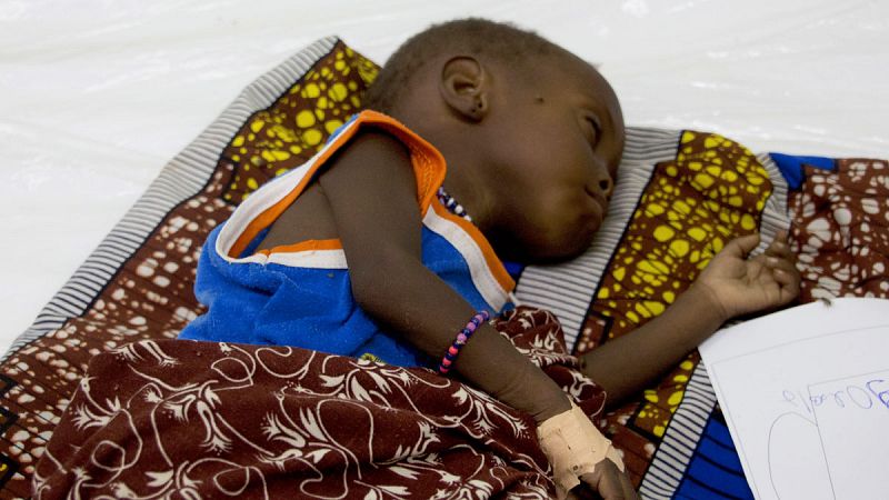 Niño hospitalizado en la unidad de tratamiento de la desnutrición severa en el Hospital general de Zinder (Níger).