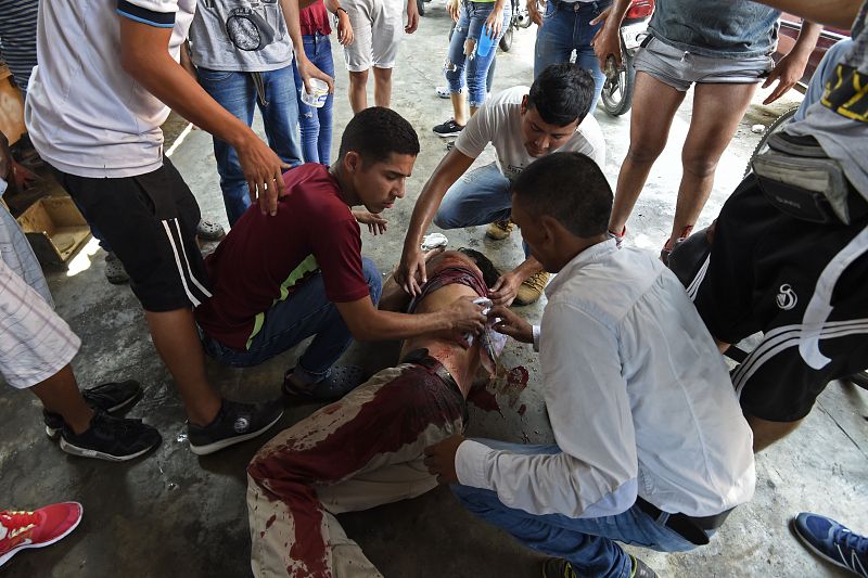 Una mujer resulta herida en los enfrentamientos en la ciudad fronteriza de Ureña