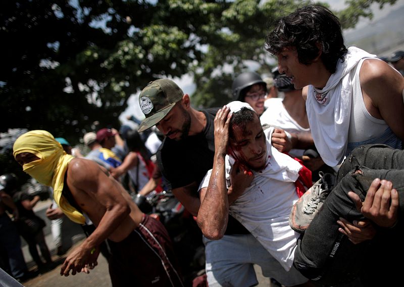 Un manifestante lesionado después de que un vehículo de la Guardia Nacional venezolana lo atropellara.