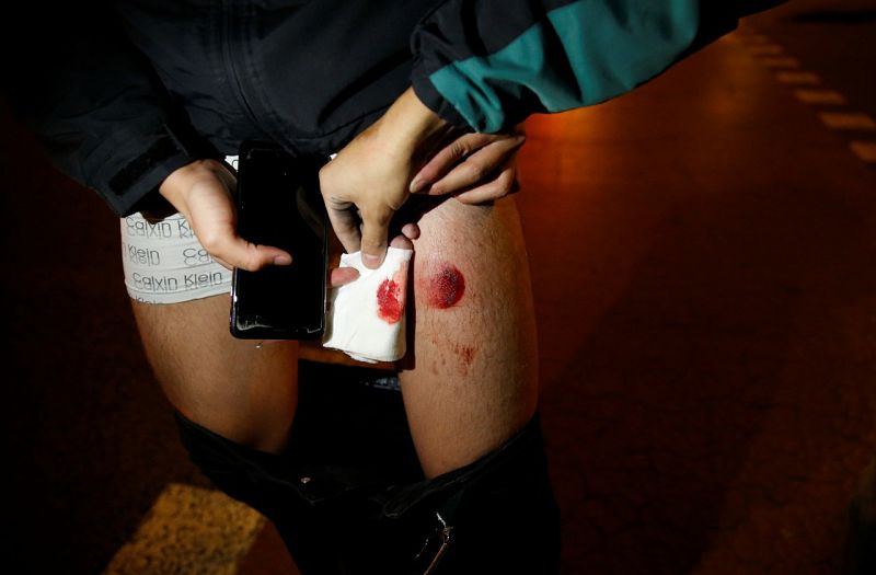  Manifestant ferit amb una pilota de goma durant els aldarrulls a Barcelona