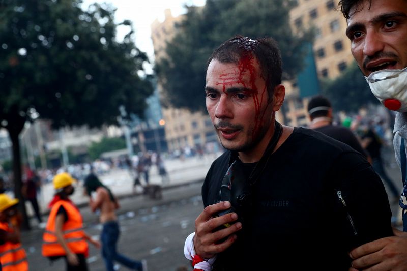 Un hombre herido en las protestas