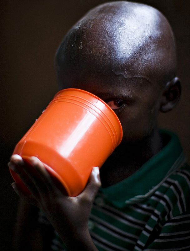 Severely malnourished Sadiki Basilaki drinks milk in eastern Congo