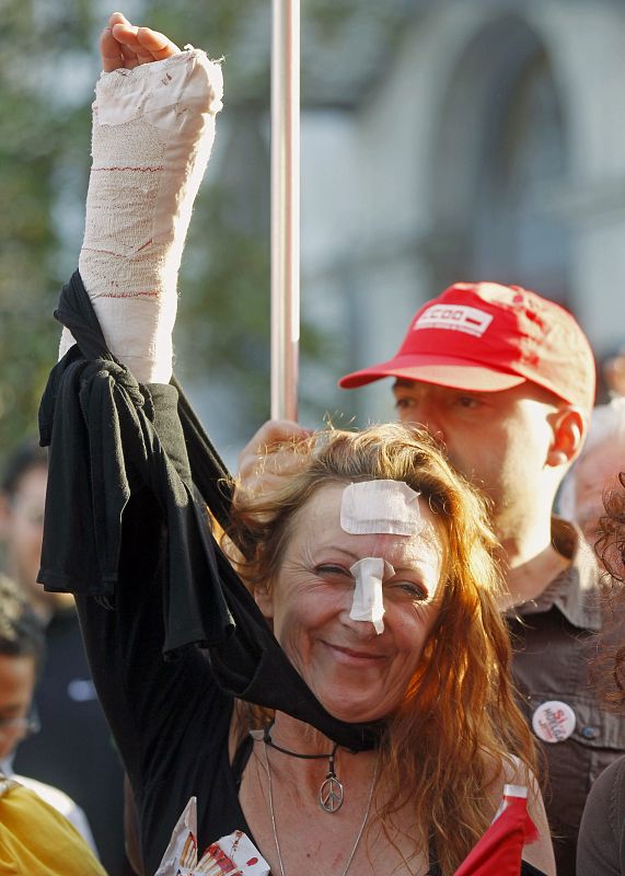 La sindicalista María Luisa Helguero, miembro de un piquete informativo y que fue herida esta mañana por el propietario de un hotel de Torrelavega, participa en la manifestación que ha recorrido esta tarde las calles de Santander.ANTANDER