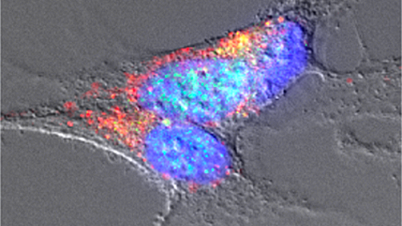 Imagen de microscopía de neuronas tratadas con amiloides bacterianos en las que se detectan agregados de α-sinucleína