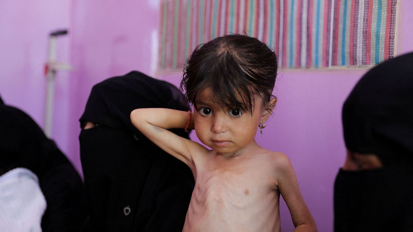 UNICEF denuncia la desnutrición infantil en Yemen