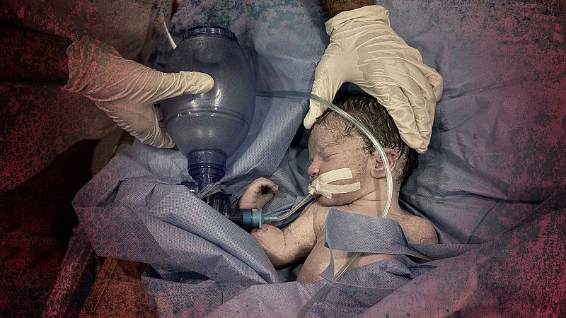 Médicos atienden a un recién nacido en Jan Yunis, Gaza, después de que su madre, embarazada de siete meses, muriera en un ataque israelí el 28 de julio de 2025.